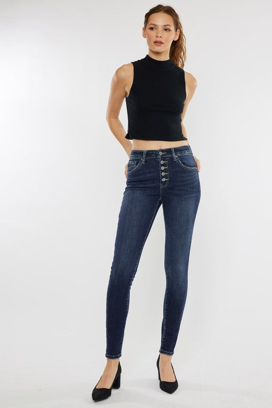 Kancan High Rise Exposed Button Jeans