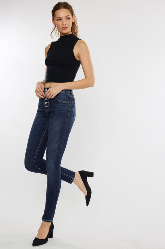 Kancan High Rise Exposed Button Jeans