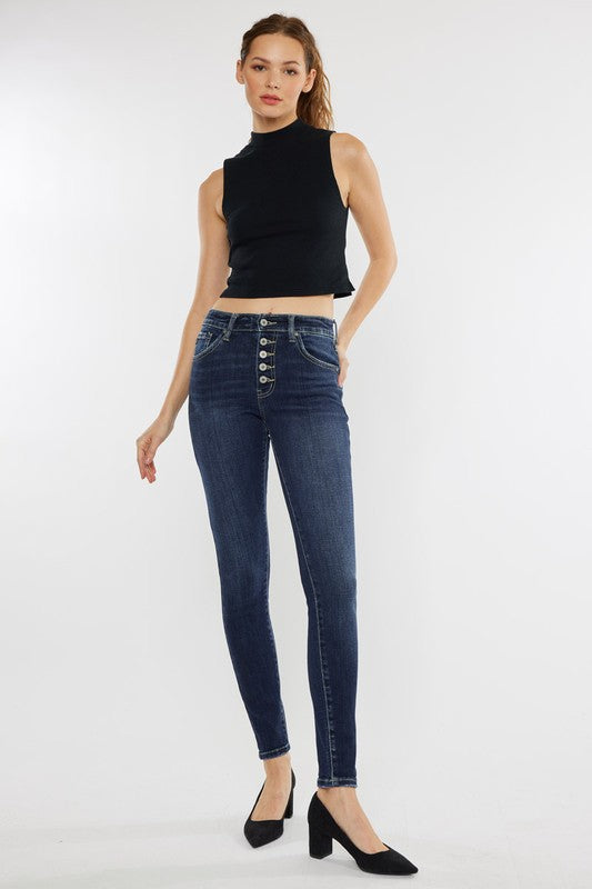 Kancan High Rise Exposed Button Jeans