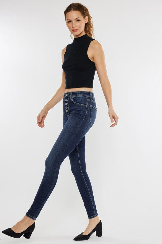 Kancan High Rise Exposed Button Jeans